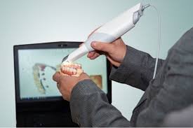 Digital intraoral scanner